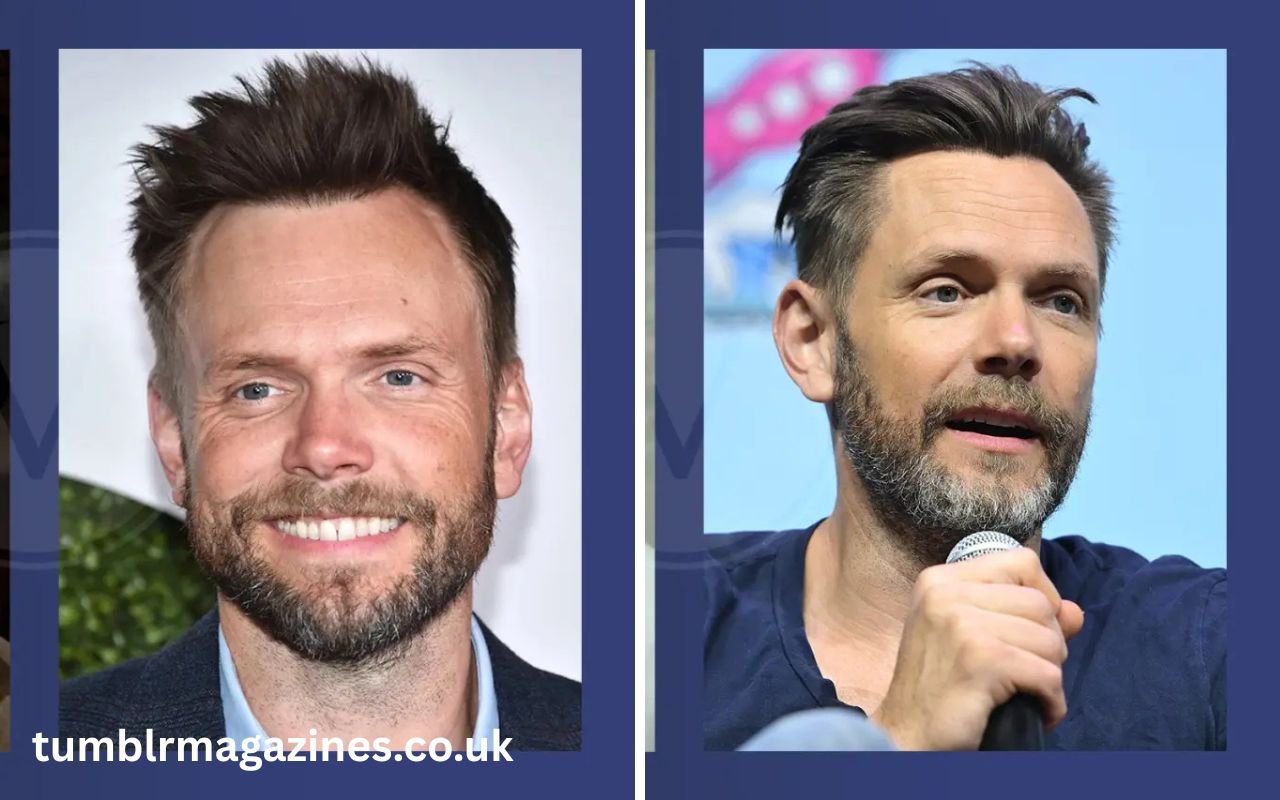joel mchale hair surgery